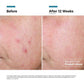 Skinceuticals Advanced RGN-6 50ml
