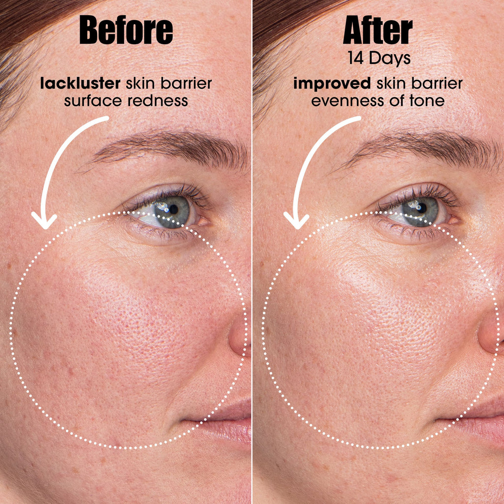 Sunday Riley AI SMART RETINOID for BLEMISH-PRONE SKIN 30ml