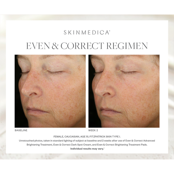 SkinMedica Even & Correct Advanced Brightening Treatment Serum