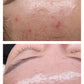 Peel da trị mụn Medik8 Cocktail Peel - Clarity