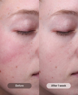 Revision Radiance+ Resurfacing Serum 30ml